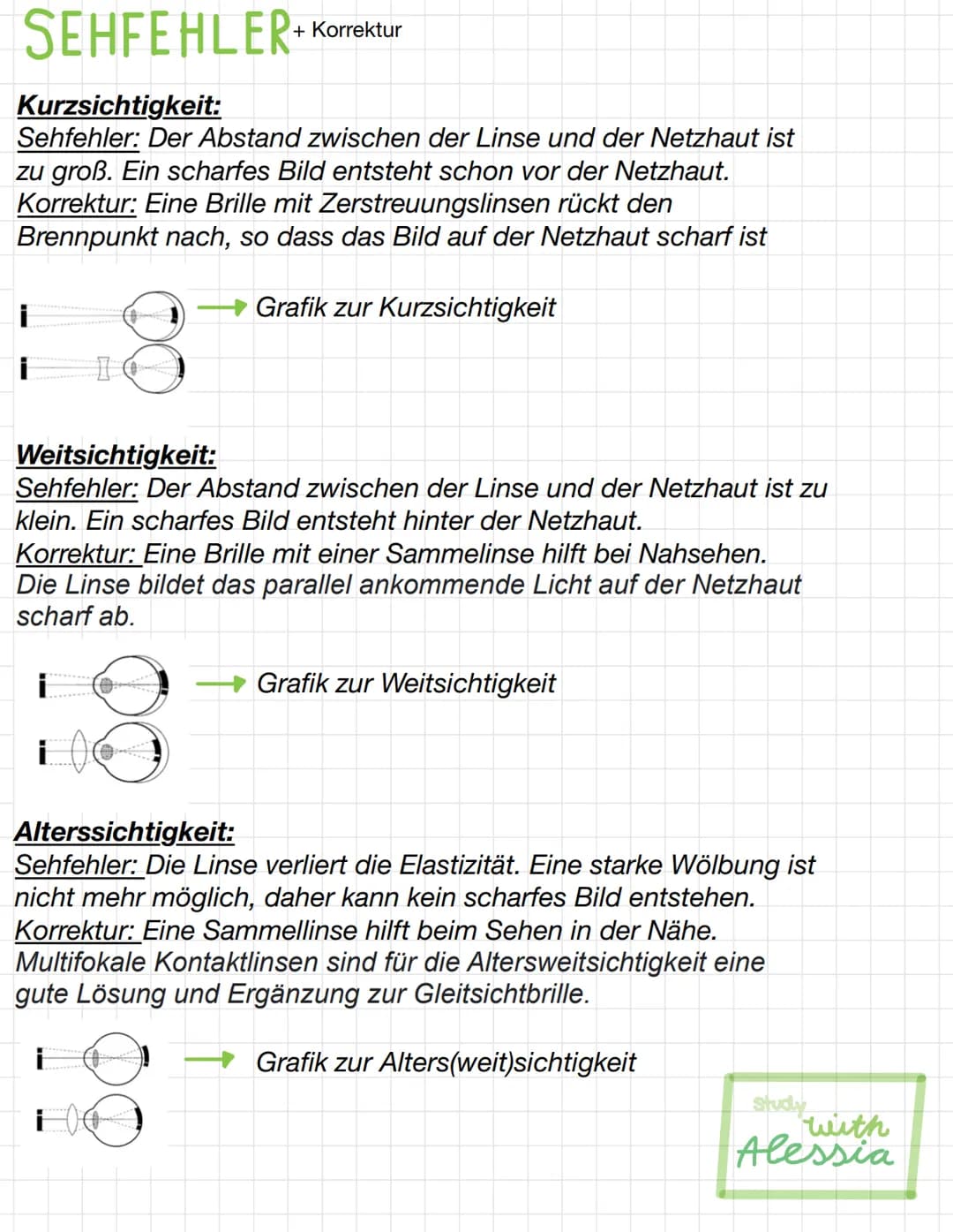 SEHFEHLER+
+ Korrektur
Kurzsichtigkeit:
Sehfehler: Der Abstand zwischen der Linse und der Netzhaut ist
zu groß. Ein scharfes Bild entsteht s