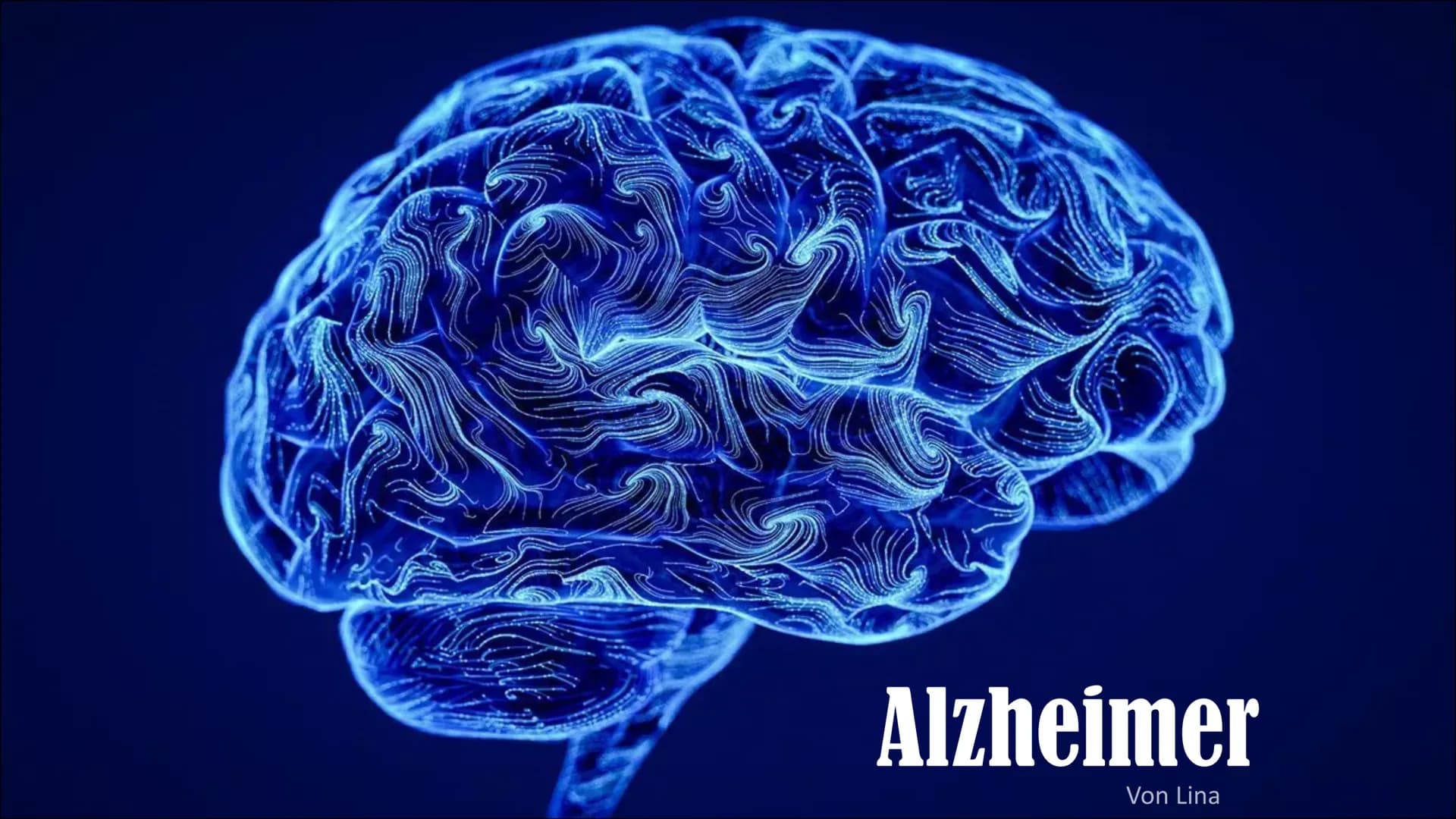 Alzheimer
Von Lina Inhaltsverzeichnis
▪ Was ist Demenz?
▪ Statistik Demenz
▪ Was ist Alzheimer?
- Geschichte Alzheimer
- Einführung
▪ Sympto