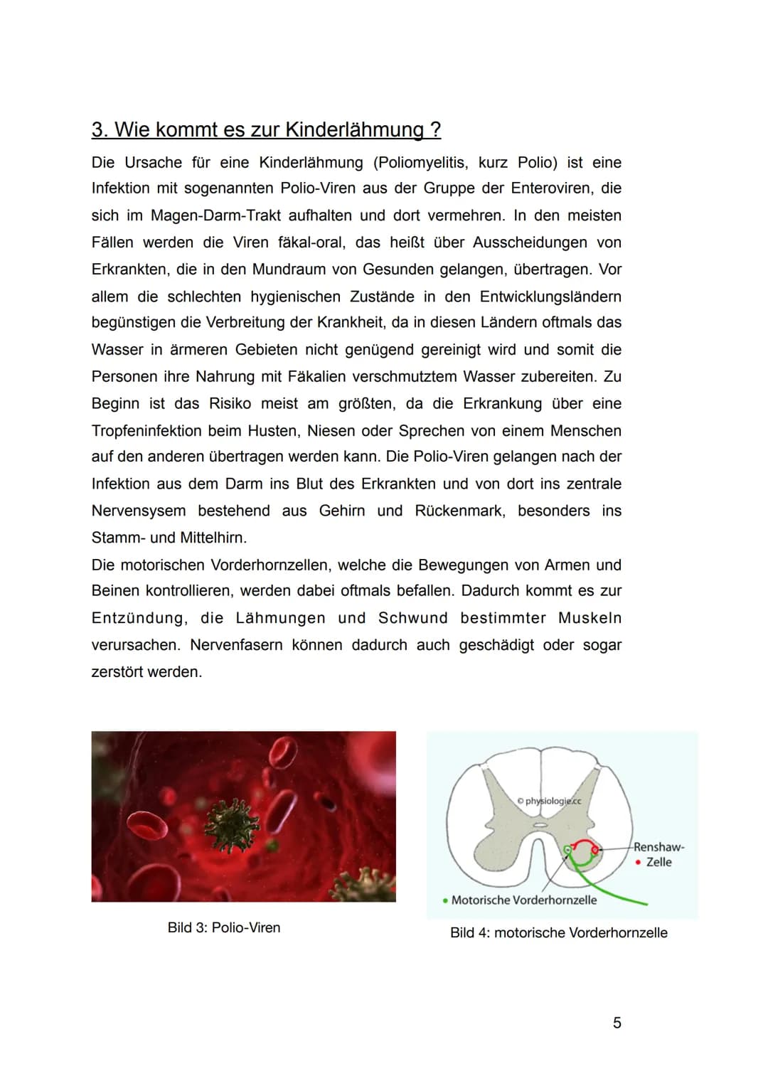 1. Einleitung
Wie auch in den 1980er Jahren AIDS ein sehr großes Thema war, prägte in
den 1950er Jahren auch die Angst vor der Kinderlähmung