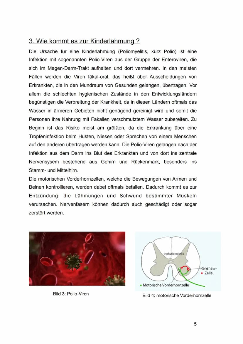 1. Einleitung
Wie auch in den 1980er Jahren AIDS ein sehr großes Thema war, prägte in
den 1950er Jahren auch die Angst vor der Kinderlähmung