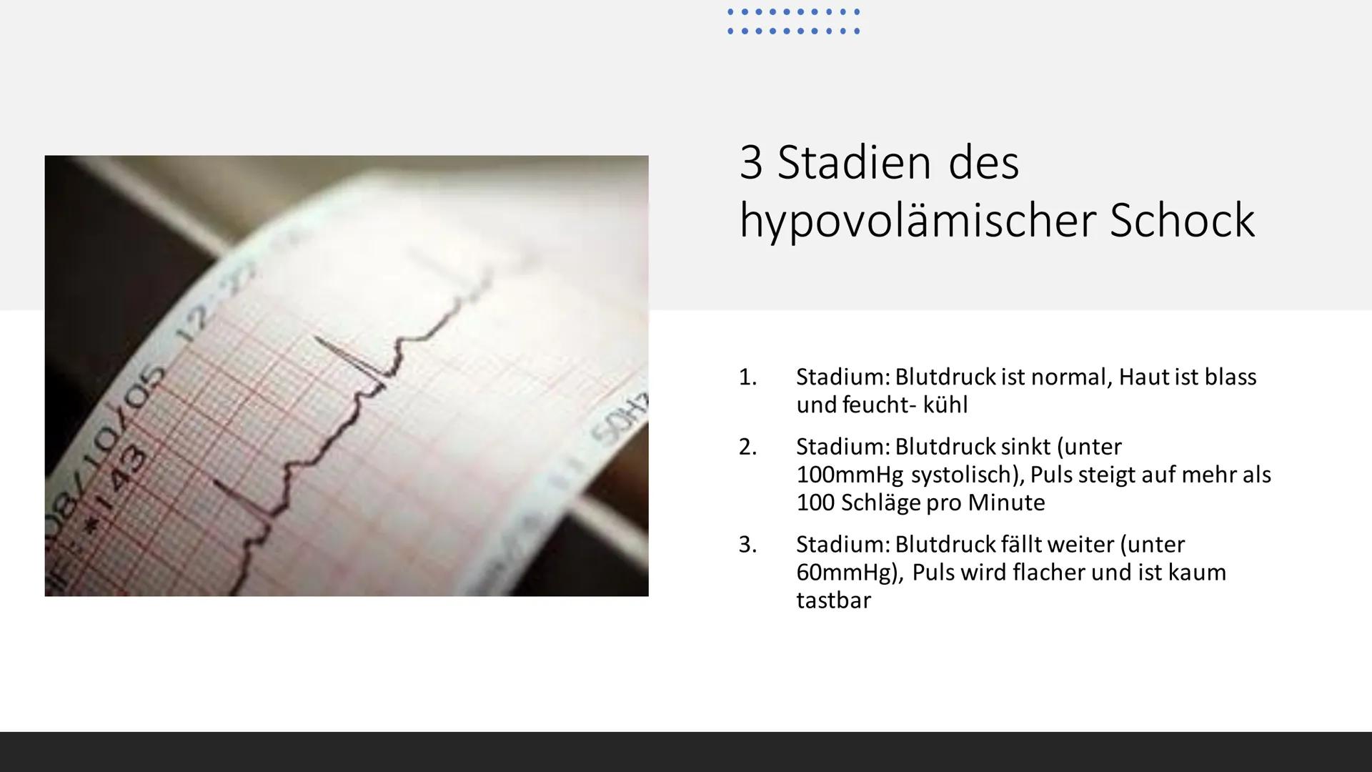 Von Lana, Ranja,
Valentina
UK
Schock im Allgemeinen ●
Gliederung
Schock im Allgemeinen; Definition
Hypovolämischer Schock; Definition, Sympt