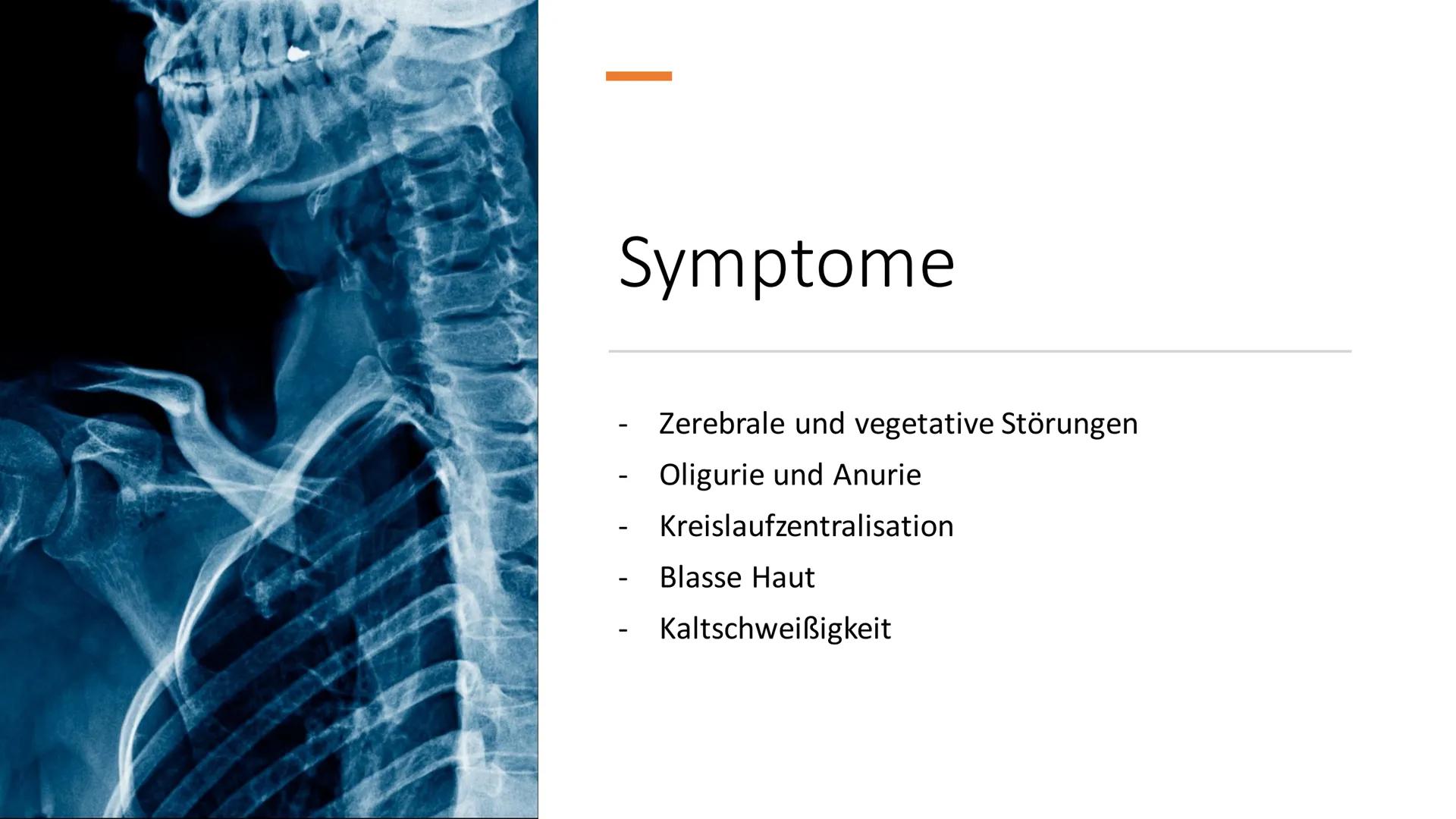 Von Lana, Ranja,
Valentina
UK
Schock im Allgemeinen ●
Gliederung
Schock im Allgemeinen; Definition
Hypovolämischer Schock; Definition, Sympt