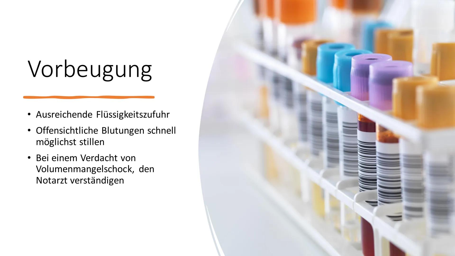 Von Lana, Ranja,
Valentina
UK
Schock im Allgemeinen ●
Gliederung
Schock im Allgemeinen; Definition
Hypovolämischer Schock; Definition, Sympt