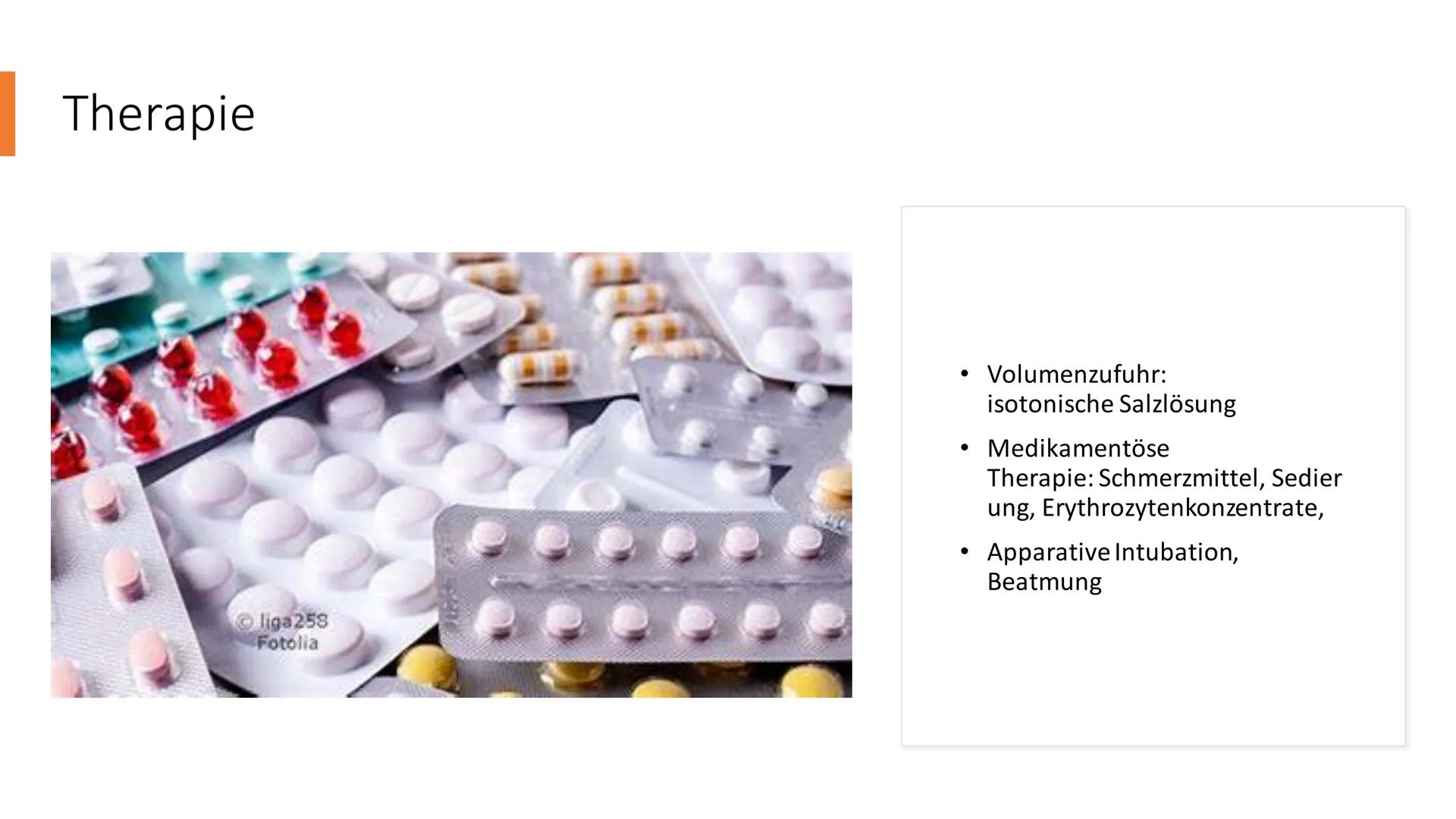 Von Lana, Ranja,
Valentina
UK
Schock im Allgemeinen ●
Gliederung
Schock im Allgemeinen; Definition
Hypovolämischer Schock; Definition, Sympt