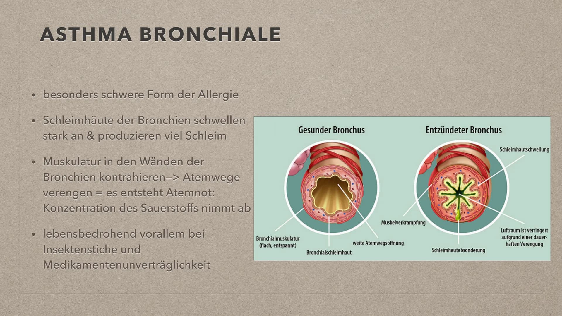 ALLERGIEN THEMENÜBERSICHT
●
• Reaktion bei Kontakt mit einem Auslöser
Symptome
Feststellung
●
●
●
Definition + Auftreten
●
Behandlungsmethod