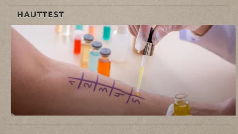 ALLERGIEN THEMENÜBERSICHT
●
• Reaktion bei Kontakt mit einem Auslöser
Symptome
Feststellung
●
●
●
Definition + Auftreten
●
Behandlungsmethod