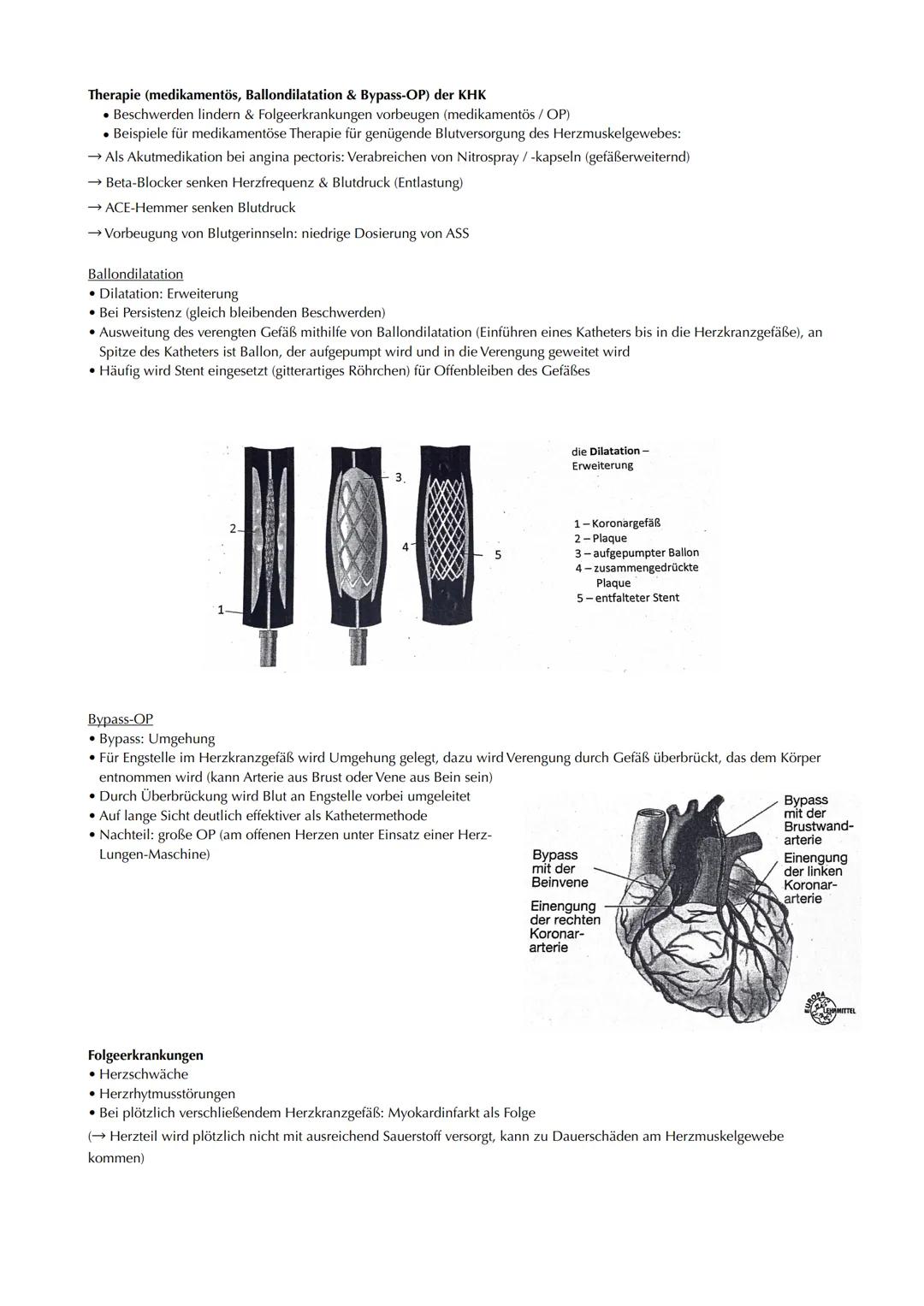 Lernfeld 05, Baustein 02
Elektrokardiogramm, konorare Herzkrankheit & Myokardinfarkt
Elektrokardiogramm (EKG)
Das Reizleitungssystem im Herz