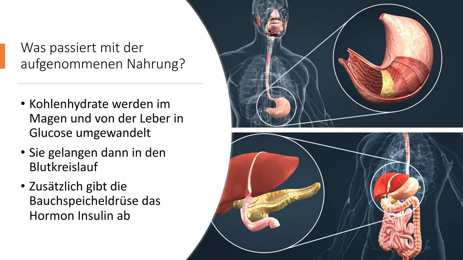  insulin
Diabetes mellitus
Von Nikolas Schmieg
E Was ist Diabetes
mellitus?
• griech. Staßaívelv= durchfließen
lat. mellitus honigsüß
• Haup