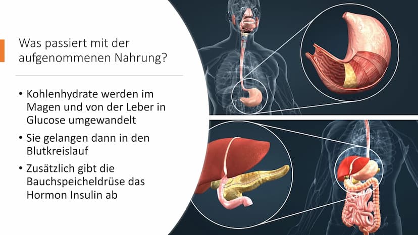  insulin
Diabetes mellitus
Von Nikolas Schmieg
E Was ist Diabetes
mellitus?
• griech. Staßaívelv= durchfließen
lat. mellitus honigsüß
• Haup