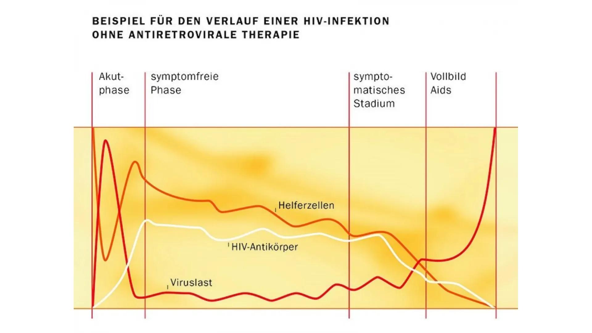 HIV/AIDS Gliederung

*   Was ist AIDS
*   Was ist HIV?
*   HIV und AIDS: Was ist der Unterschied?
*   Wie wird HIV übertragen?
*   HIV Sympt