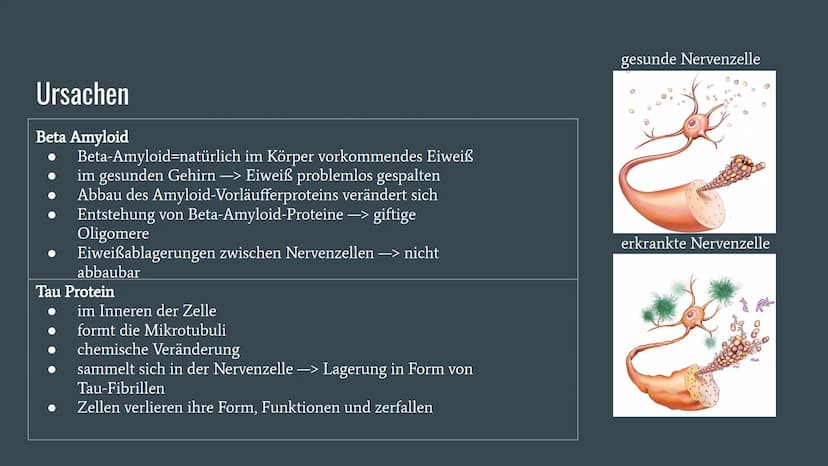 Alzheimer
Präsentation von Dennisa Dobrila
Grundkurs Biologie Gliederung
1. Alzheimer Forschung Initiative e.V.
2. Was ist Alzheimer?
3.
Ges