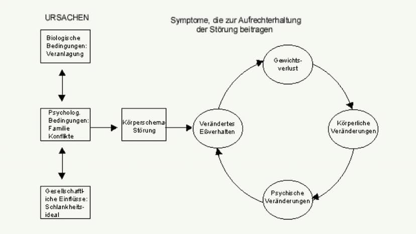 Eine Präsentation über
Essstörungen
ICD-10-Code: F50 1. Essstörung Begriffserklärung
2. Ätiologie
3. Symptome
4.
Interventionsmöglichkeiten
