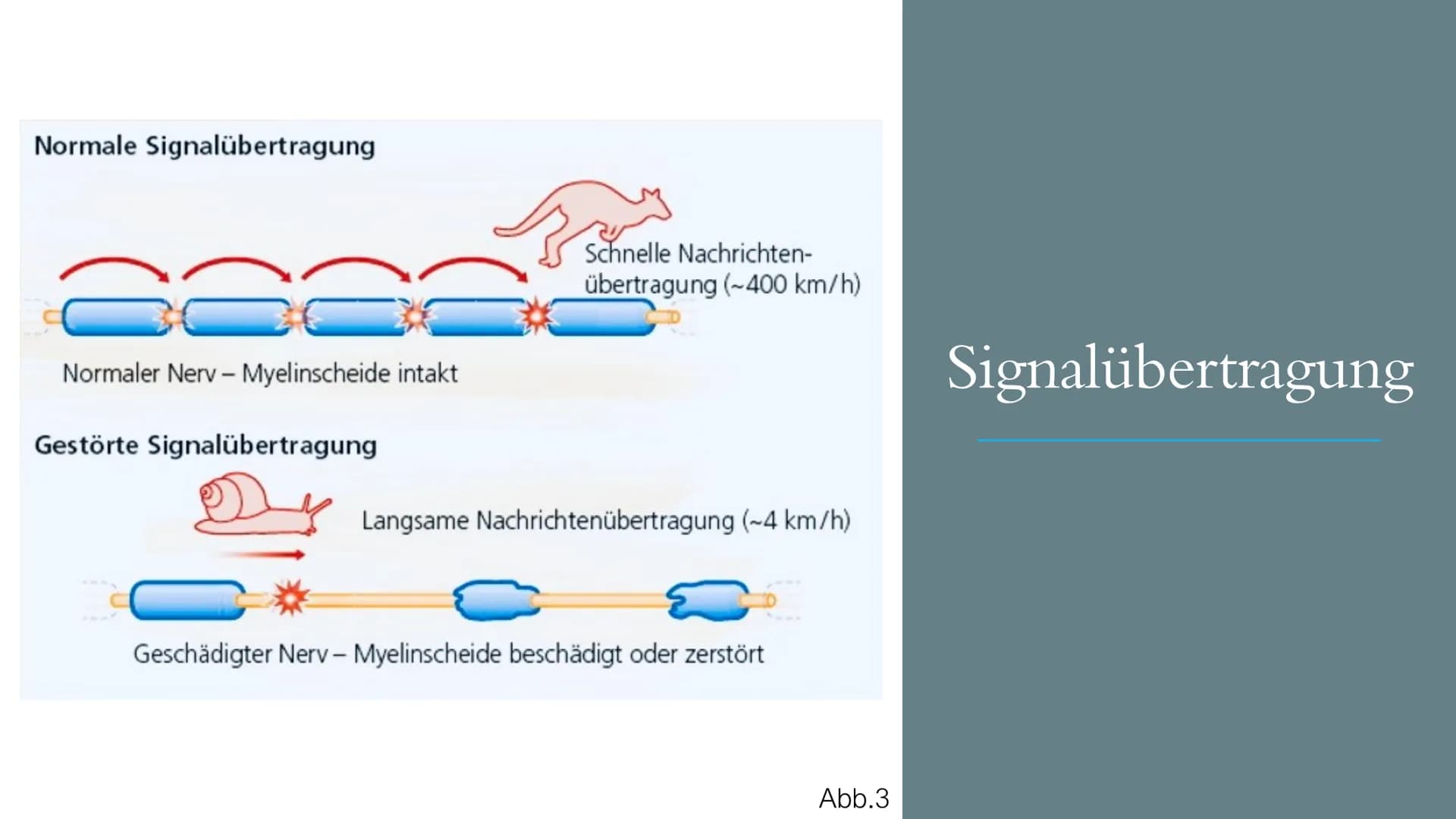 https://gesundpedia.de/images/ZNS.jpg Abb. 1
Multiple
Sklerose
„EINE KRANKHEIT MIT TAUSEND
NERGIS
GESICHTERN"
; S4; NEUROBIOLOGIE; PGS GLIED