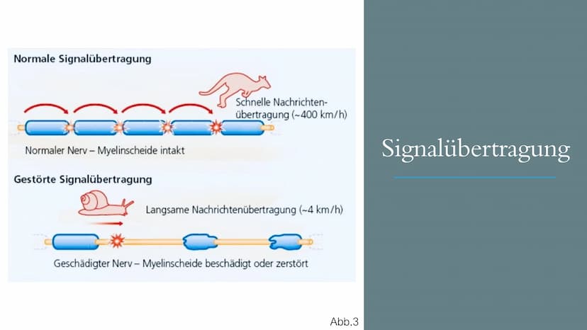 https://gesundpedia.de/images/ZNS.jpg Abb. 1
Multiple
Sklerose
„EINE KRANKHEIT MIT TAUSEND
NERGIS
GESICHTERN"
; S4; NEUROBIOLOGIE; PGS GLIED