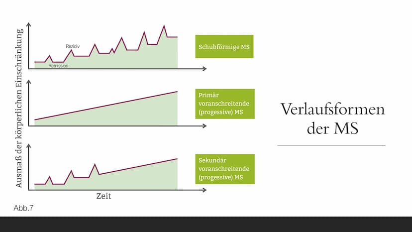 https://gesundpedia.de/images/ZNS.jpg Abb. 1
Multiple
Sklerose
„EINE KRANKHEIT MIT TAUSEND
NERGIS
GESICHTERN"
; S4; NEUROBIOLOGIE; PGS GLIED