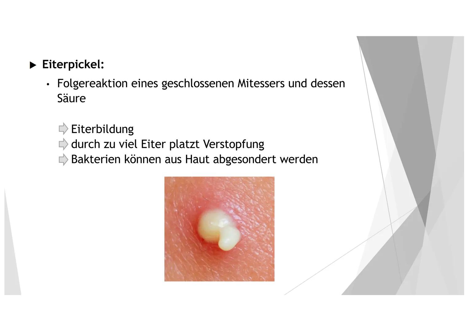 AKNE DIE GLIEDERUNG
1. DER EINSTIEG
2. GENERELLE INFORMATIONEN ZU AKNE
3.
4. DIE HAUT
5. DIE ENTSTEHUNG UND ARTEN VON LÄSIONEN
6.
DIE URSACH