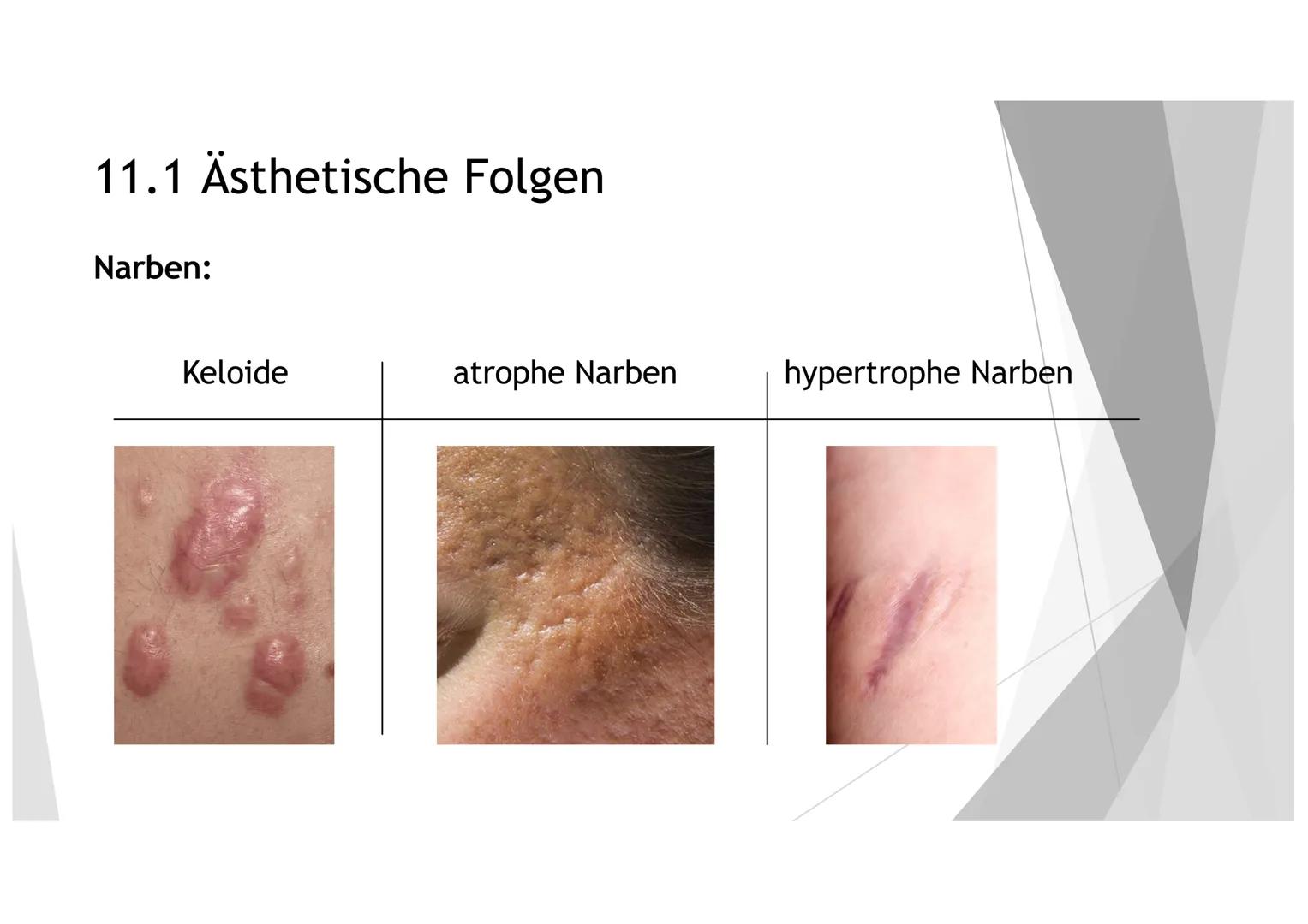 AKNE DIE GLIEDERUNG
1. DER EINSTIEG
2. GENERELLE INFORMATIONEN ZU AKNE
3.
4. DIE HAUT
5. DIE ENTSTEHUNG UND ARTEN VON LÄSIONEN
6.
DIE URSACH