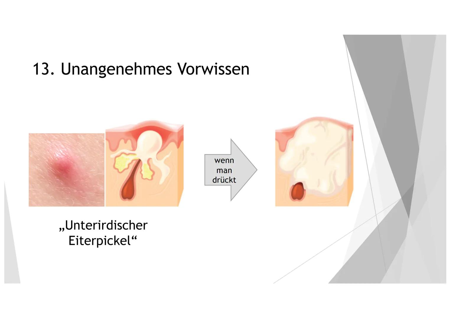 AKNE DIE GLIEDERUNG
1. DER EINSTIEG
2. GENERELLE INFORMATIONEN ZU AKNE
3.
4. DIE HAUT
5. DIE ENTSTEHUNG UND ARTEN VON LÄSIONEN
6.
DIE URSACH