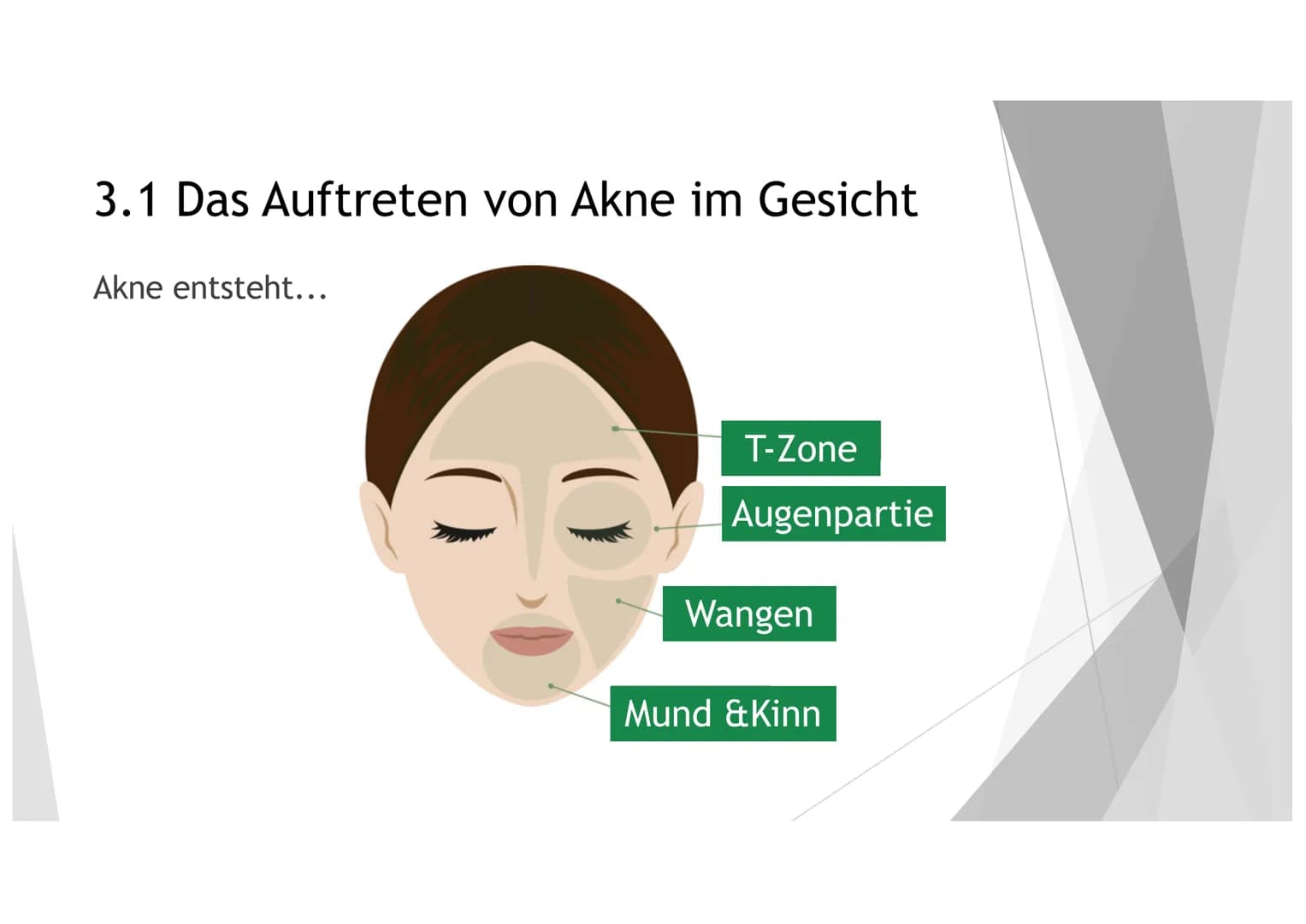 AKNE DIE GLIEDERUNG
1. DER EINSTIEG
2. GENERELLE INFORMATIONEN ZU AKNE
3.
4. DIE HAUT
5. DIE ENTSTEHUNG UND ARTEN VON LÄSIONEN
6.
DIE URSACH