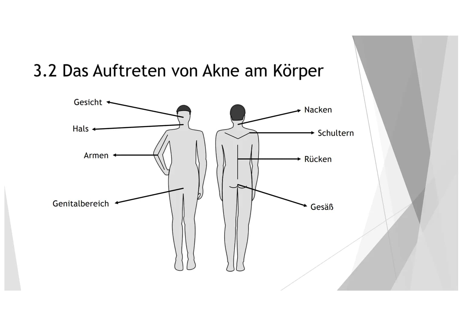 AKNE DIE GLIEDERUNG
1. DER EINSTIEG
2. GENERELLE INFORMATIONEN ZU AKNE
3.
4. DIE HAUT
5. DIE ENTSTEHUNG UND ARTEN VON LÄSIONEN
6.
DIE URSACH