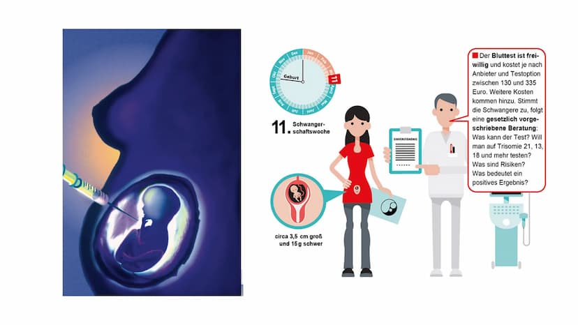 Trisomie 21 Inhaltsverzeichnis
1. Allgemeine Informationen
2. Krankheitsbild
2.1. Äußerliche Merkmale
2.2. Gesundheitliche Folgen
3. Bevölke
