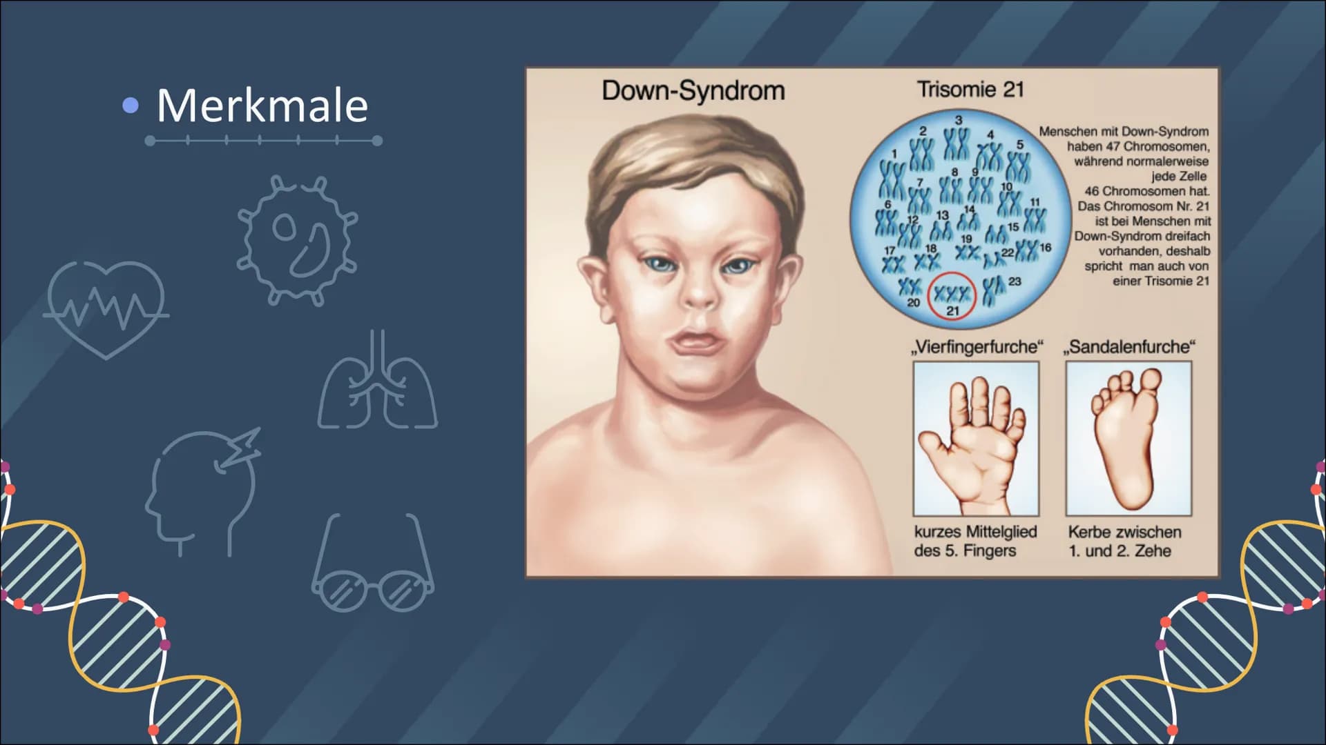 GENETIK
TRISOMIE 21
INKAN Inhaltsverzeichnis
01
02
03
Definition
Was ist Trisomie 21?
Definition
Was sind Chromosomen?
Symptome & Merkmale
W