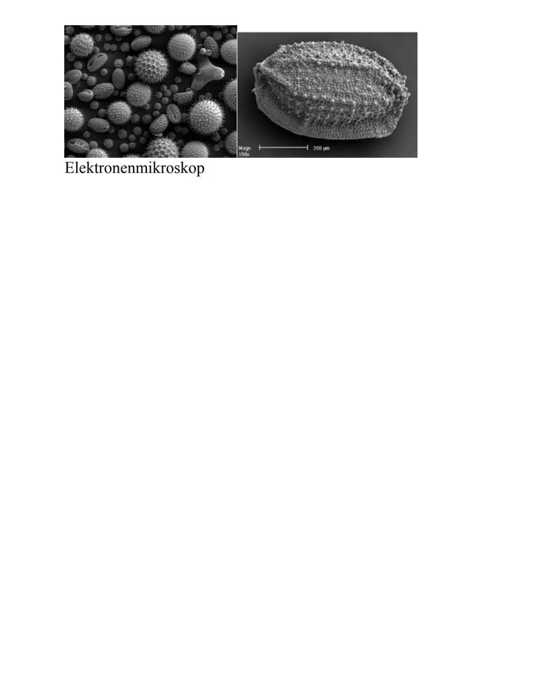 Eukaryoten:
→ Zellkern mit Kernhülle, diploid
→getrennte Reaktionsräume durch Membranen
→ diverse Organellen mit speziellen Funktionen (z.B.