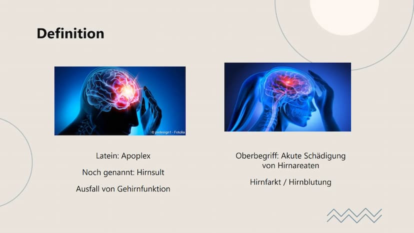 Schlaganfall
Alles rund um den Schlaganfall.
O Gliederung
1
3
Definition
Apoplex - Hirnsult
Behandlung - Prävention
Therapien, Rehabilitatio