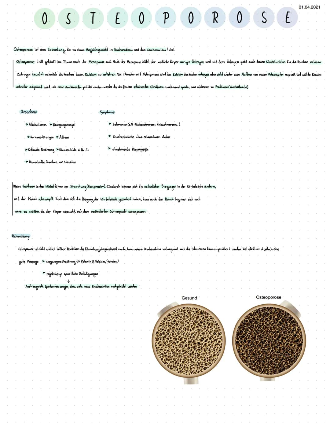 
<h2 id="ursachenvonosteoporosebeifrauen">Ursachen von Osteoporose bei Frauen</h2>
<p>Osteoporose ist eine Erkrankung, die zu einem Ungleich