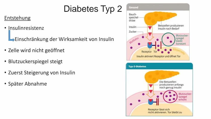 Diabetes Typ 1 und 2
01
STOP
DIABETES • Einführung
• Was ist Insulin?
●
Agenda
Diabetes Typ 1 + Symptome
Diabetes Typ 2 + Ursachen + Symptom