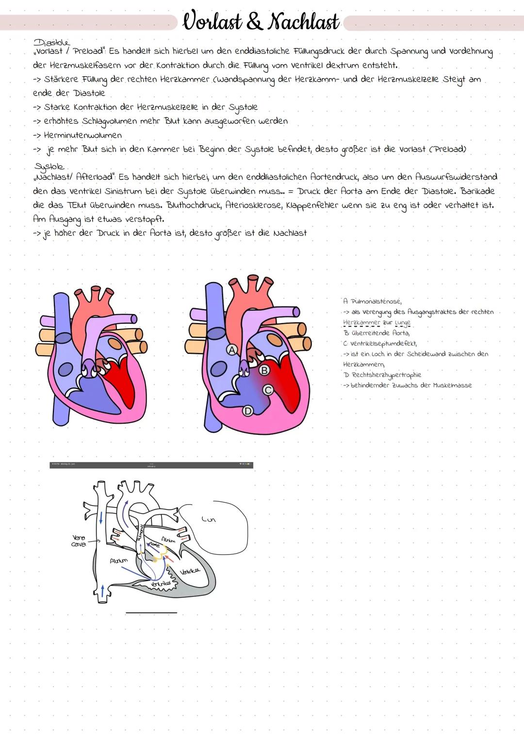27.04.2022

# Erregungsbildung

## Erregungsbildungssystem

Sinusknoten
AV-Knoten
His-Bindel
linker Tawaraschenkel
Sinusknoten (Primärer Sch