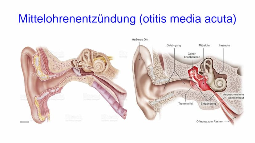 Fallbeispiel
•Eine Mutter kommt mit ihrem 3-jährigen Sohn in eine Arztpraxis
•Sie berichtet, dass sie einkaufen waren, und der Schnuller auf