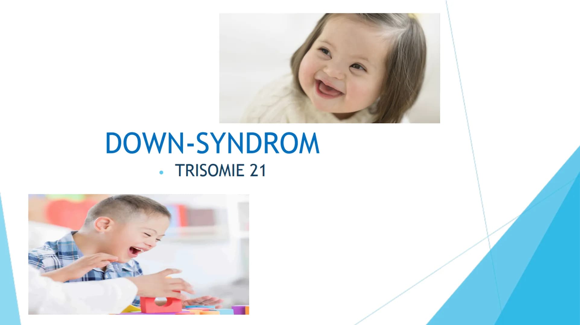 DOWN-SYNDROM
TRISOMIE 21 Inhaltsverzeichnis
1. Definition der Erkrankung
2. Mutation
3. Ursache
4. Formen der Erkrankung
Freie Trisomie 21
T