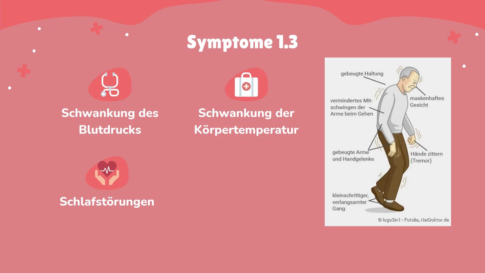 Morbus
Parkinson 1
Begriffserklärung
4
Häufigkeit
Inhaltsverzeichnis 1.1
2
Allgemeines
5
Ursache der
Parkinson
Erkrankung
3
Zum Entdecker
6
