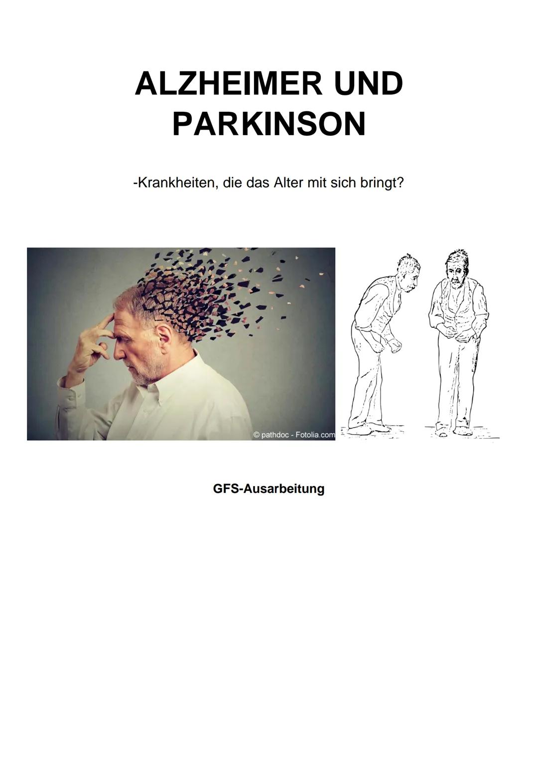 # ALZHEIMER UND
PARKINSON

-Krankheiten, die das Alter mit sich bringt?

pathdoc - Fotolia.com

GFS-Ausarbeitung Inhaltsverzeichnis

Alzheim