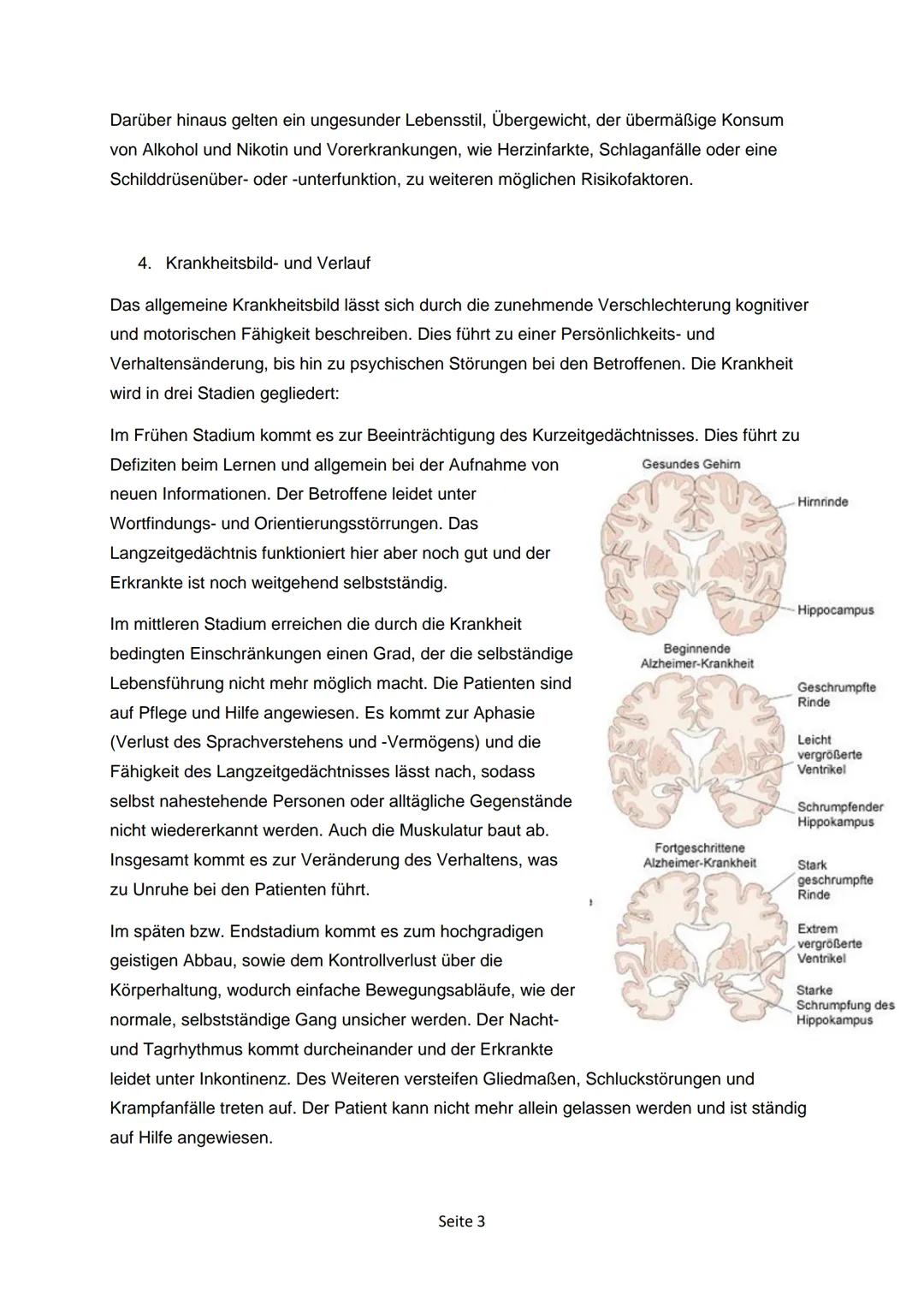 # ALZHEIMER UND
PARKINSON

-Krankheiten, die das Alter mit sich bringt?

pathdoc - Fotolia.com

GFS-Ausarbeitung Inhaltsverzeichnis

Alzheim