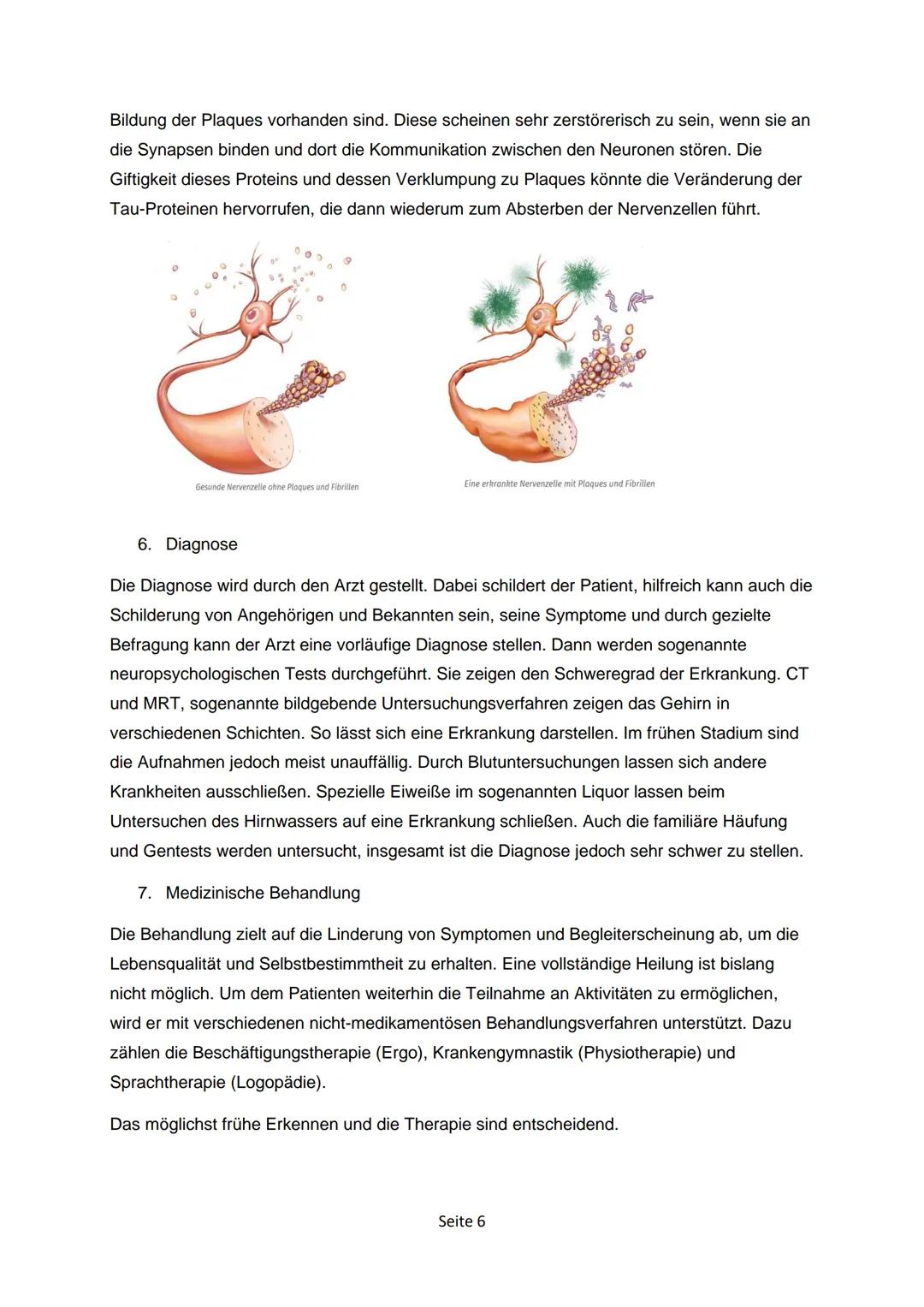 # ALZHEIMER UND
PARKINSON

-Krankheiten, die das Alter mit sich bringt?

pathdoc - Fotolia.com

GFS-Ausarbeitung Inhaltsverzeichnis

Alzheim