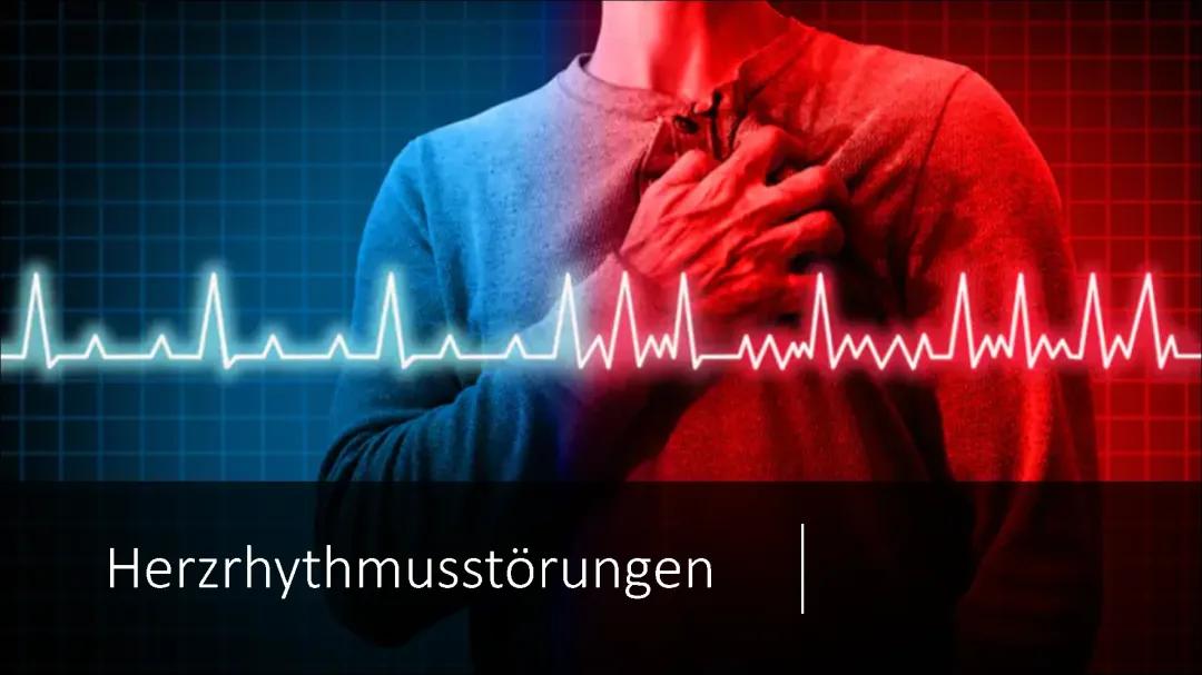 Herzrhythmusstörungen 
