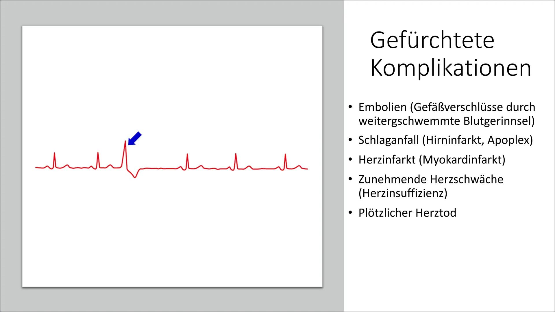 ܐܐܐܐܐܐܝܝܐܝܝܐܝܝܐ
Л
Herzrhythmusstörungen Inhaltsverzeichnis
• Definition
• Arten von
Herzrhythmusstörungen
●
Entstehung
Risikofaktoren
• Mögl