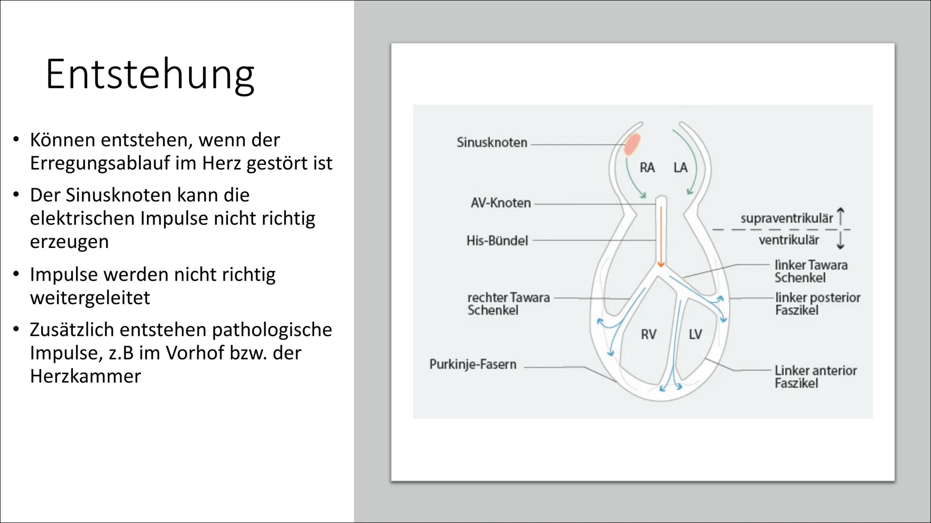ܐܐܐܐܐܐܝܝܐܝܝܐܝܝܐ
Л
Herzrhythmusstörungen Inhaltsverzeichnis
• Definition
• Arten von
Herzrhythmusstörungen
●
Entstehung
Risikofaktoren
• Mögl