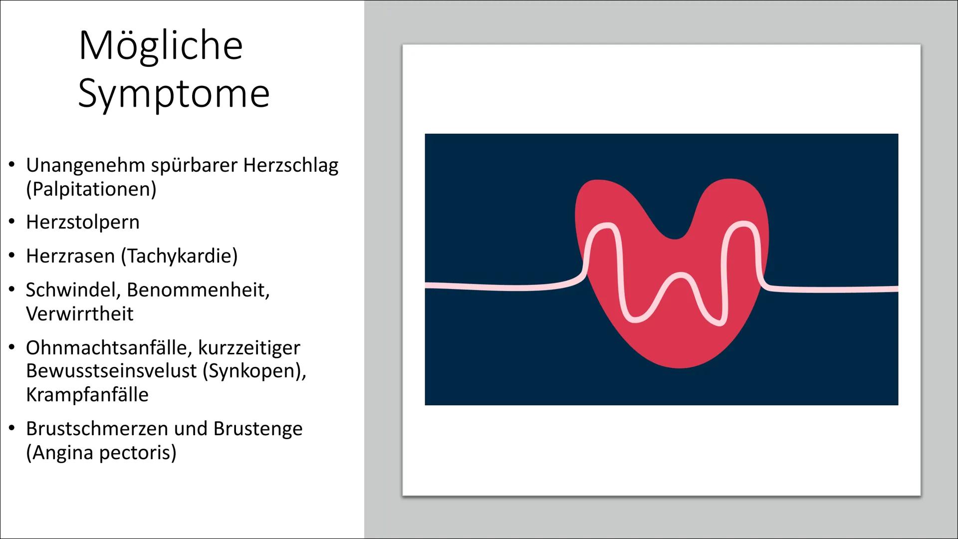 ܐܐܐܐܐܐܝܝܐܝܝܐܝܝܐ
Л
Herzrhythmusstörungen Inhaltsverzeichnis
• Definition
• Arten von
Herzrhythmusstörungen
●
Entstehung
Risikofaktoren
• Mögl