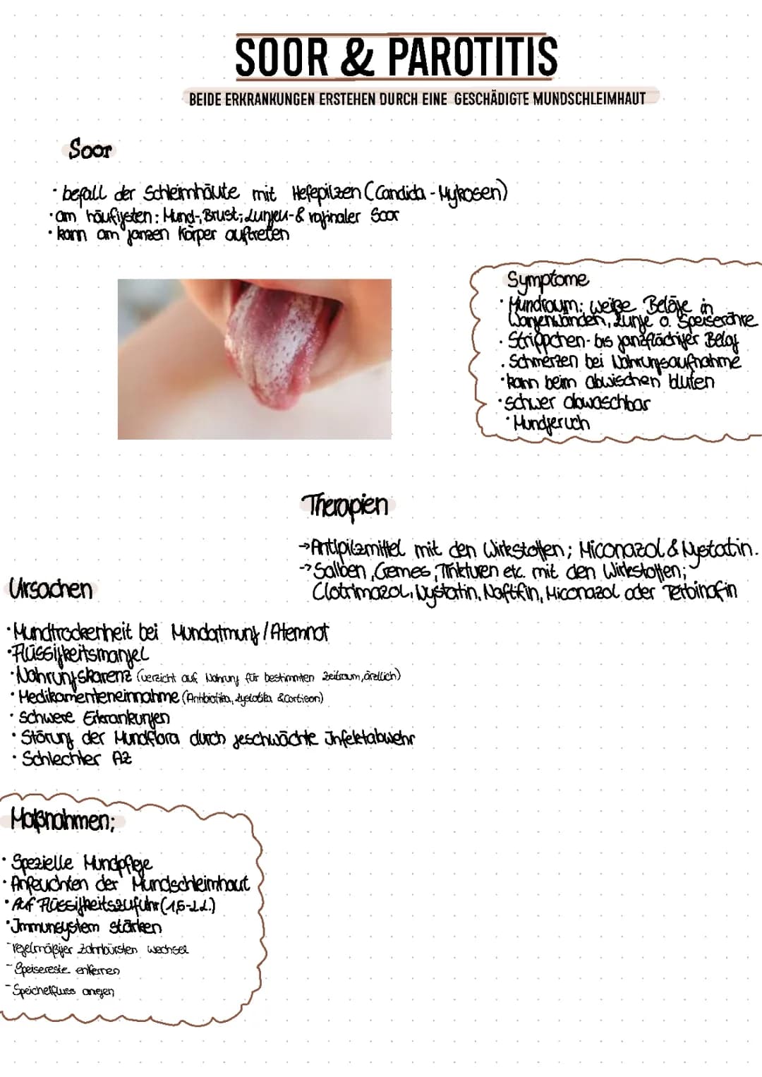 Soor & Parotitis 