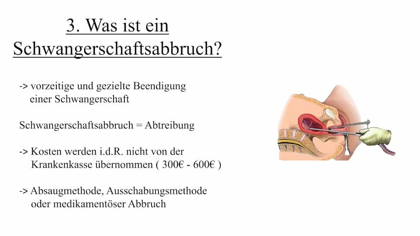 Zina Delloui, W12a
...ich möchte kein
Kind, bin ich
deswegen ein
schlechter Mensch..? Lässt sich ein Schwangerschaftsabbruch rechtfertigen?
