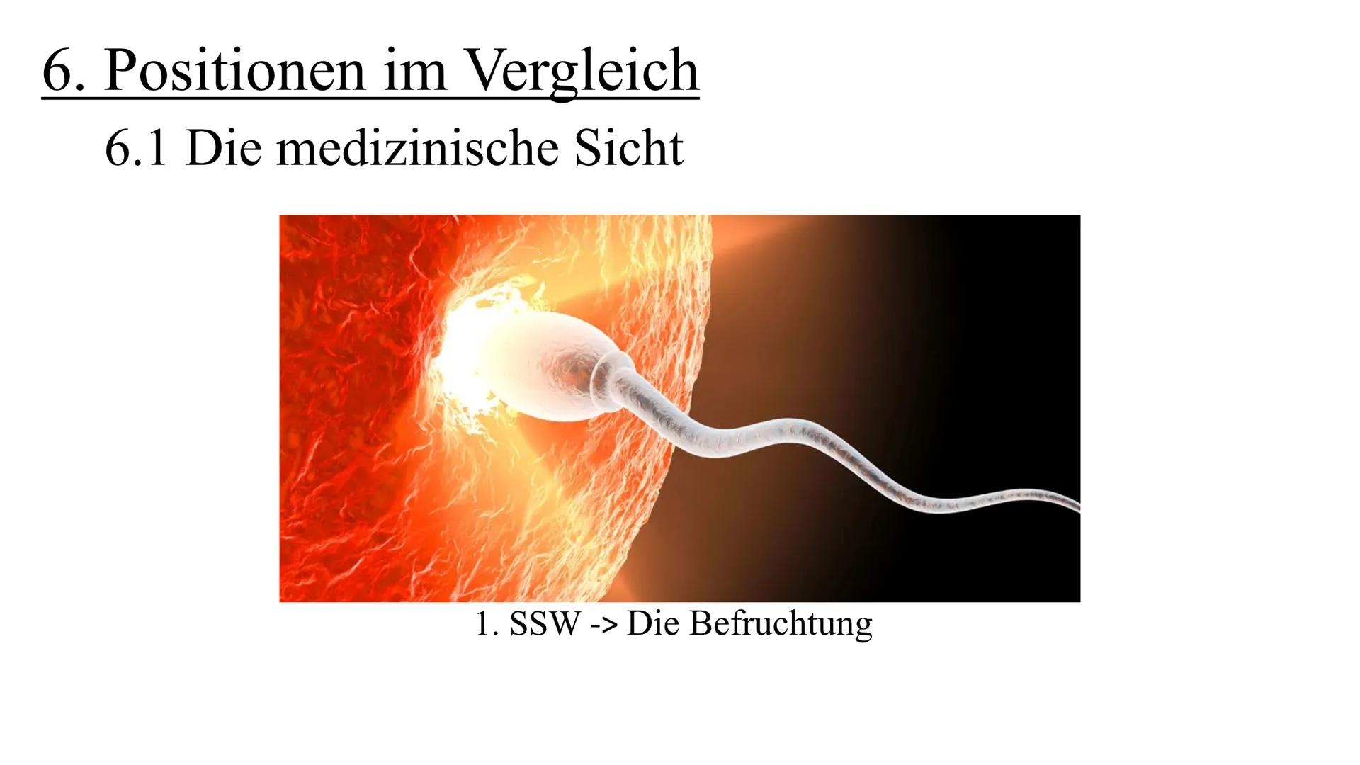 Zina Delloui, W12a
...ich möchte kein
Kind, bin ich
deswegen ein
schlechter Mensch..? Lässt sich ein Schwangerschaftsabbruch rechtfertigen?
