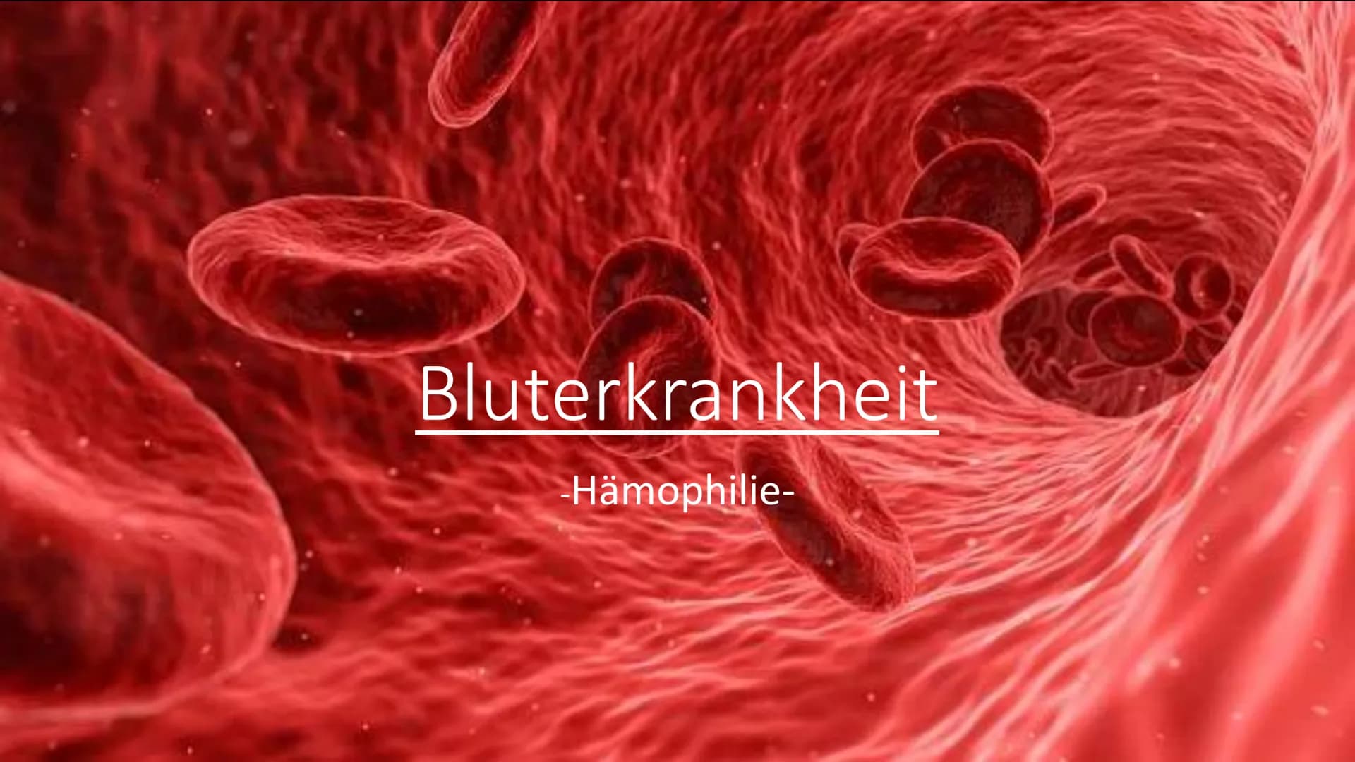 Bluterkrankheit
-Hämophilie- Kurzbeschreibung der Krankheit:
Hämophilie ist eine angeborene Krankheit oder kann auch aus unerklärlichen
Grün