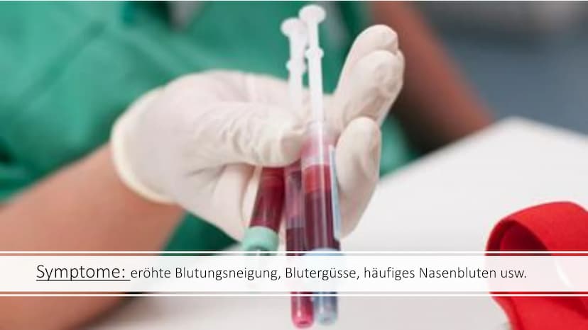 Bluterkrankheit
-Hämophilie- Kurzbeschreibung der Krankheit:
Hämophilie ist eine angeborene Krankheit oder kann auch aus unerklärlichen
Grün