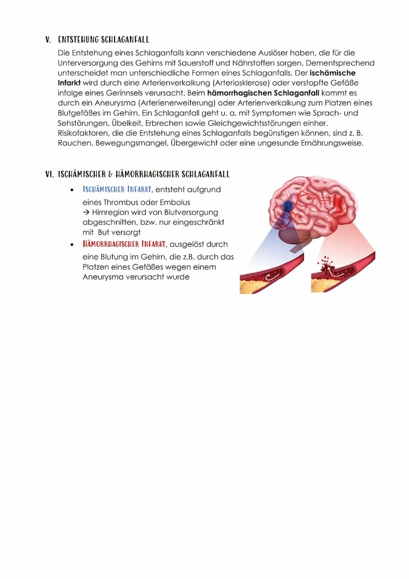 P1 ABITUR
Apoplex
PATHOGENESE DES SCHLAGANFALLS
I. TRANSITORISCH ISCHÄMISCHE ATTACKE (TIA)
TIA, eine Vorstufe des Schlaganfalls. Es kommt zu