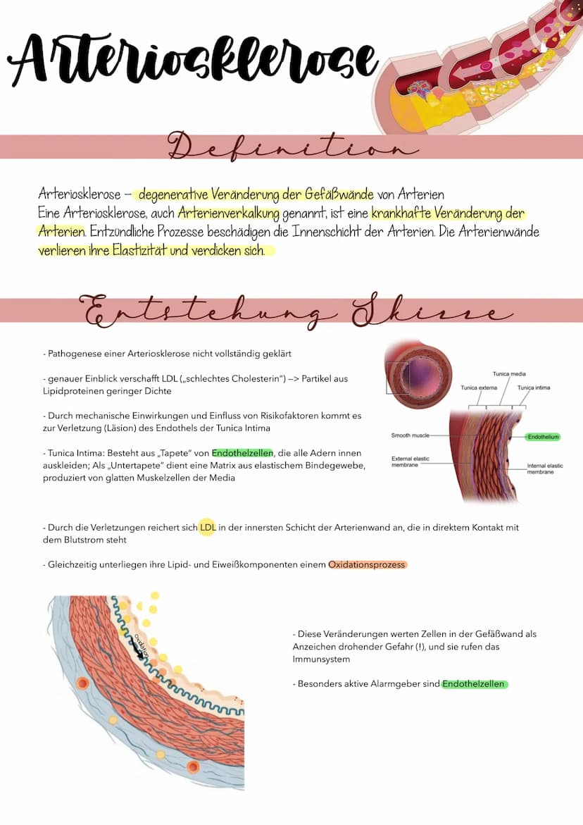 P1 ABITUR
Apoplex
PATHOGENESE DES SCHLAGANFALLS
I. TRANSITORISCH ISCHÄMISCHE ATTACKE (TIA)
TIA, eine Vorstufe des Schlaganfalls. Es kommt zu