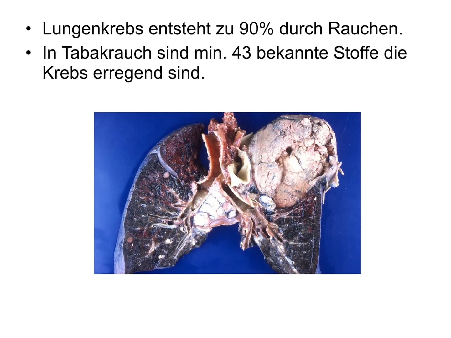 
<h2 id="1einleitung">1. Einleitung</h2>
<p>Warum habe ich mich für dieses Thema entschieden? Ich wurde täglich mit dem Rauchen konfrontiert
