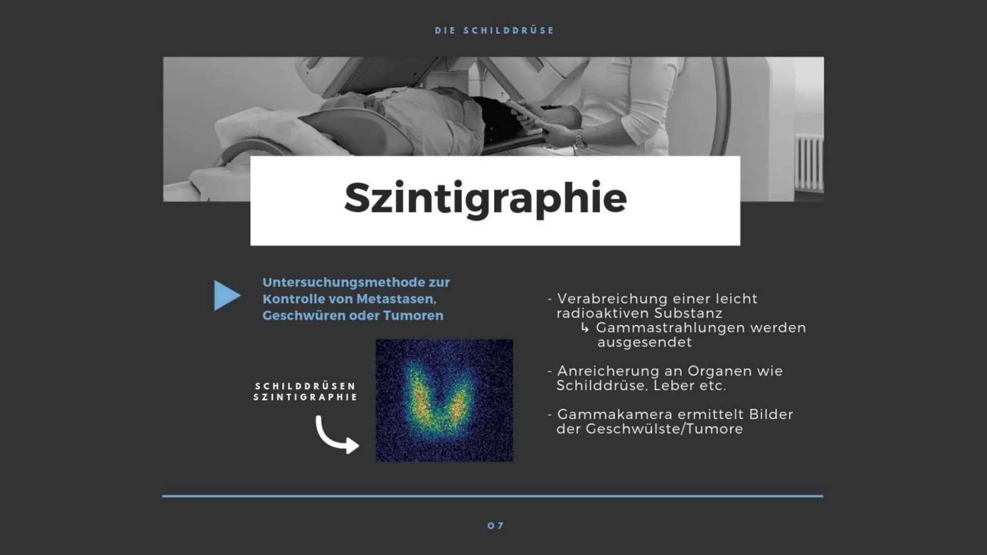 M
K
BIOLOGIE PRÄSENTATION
DIE
SCHILDDRÜSE Gliederung
> Allgemeines
Die Thyroxinherstellung
a) Wirkung
b) Regulationsprinzip
c) Regelkreissch